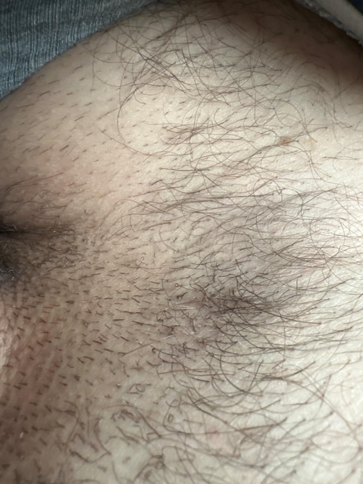 Braun Smart IPL Skin i Expert Pro 7, IPL Hair Removal for Women and Men, Permanent Laser Hair Reduction At-Home, World's 1st Smart App, 3 Heads, IPL7243 customer photo 2