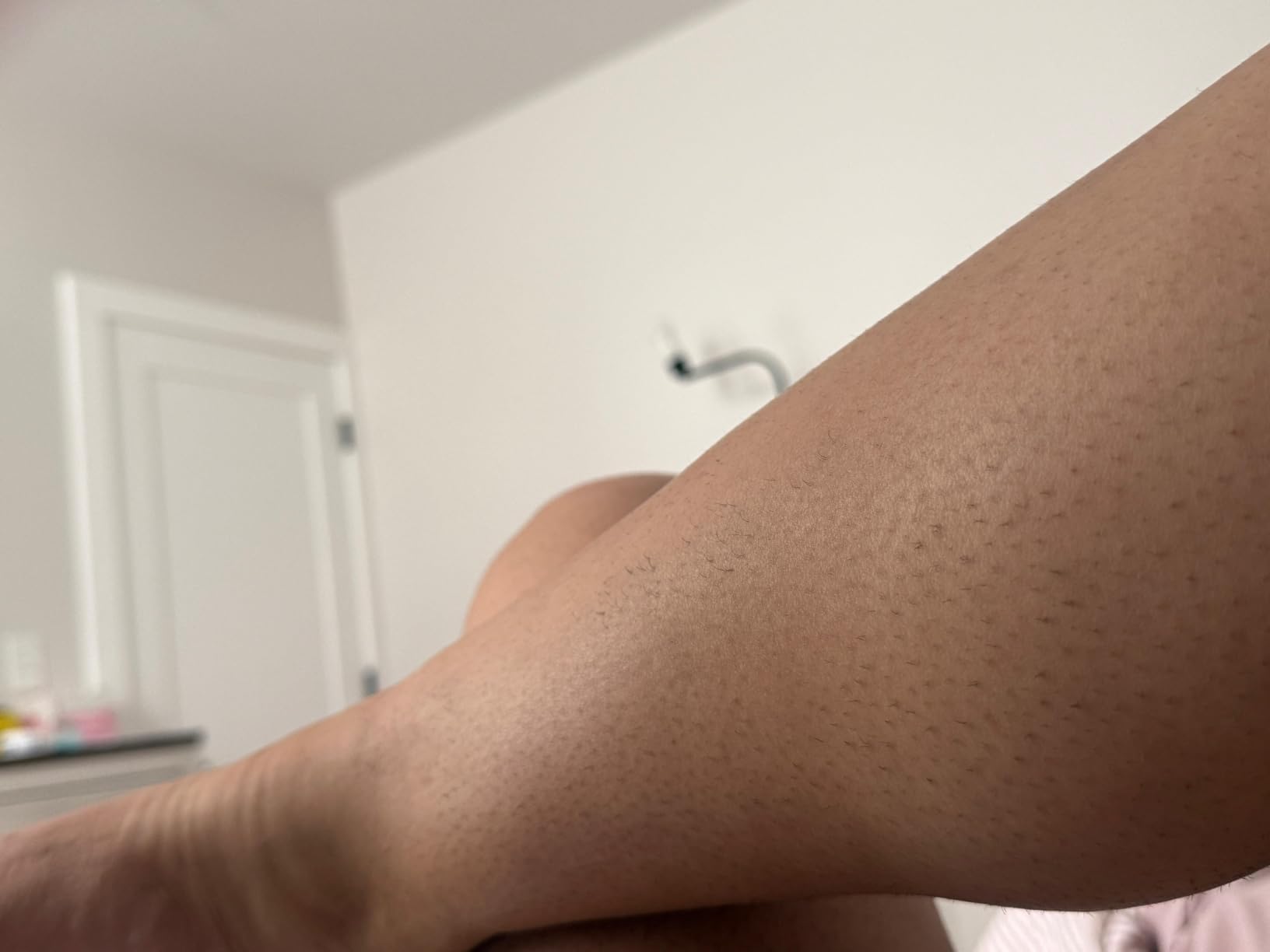 Philips Lumea IPL Salon-Like Laser Hair Removal for Women, Permanent Hair Reduction Device At Home for Face & Body, BRI984/03 customer photo 1