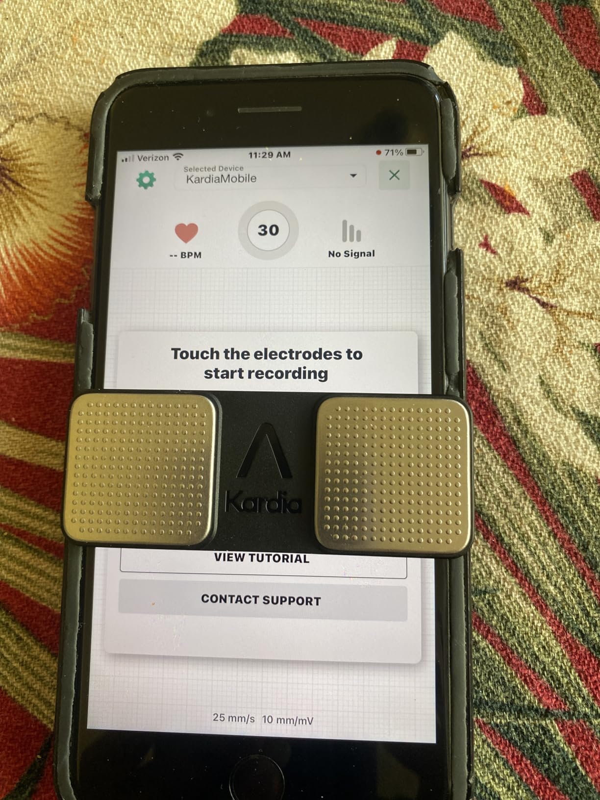 KardiaMobile 1-Lead EKG Monitor, Medical-Grade FDA-Cleared Personal Heart Monitor, Detects Normal, AFib & Arrhythmias, 30 Second Results, Works with Most Smartphones, HSA&FSA Eligible customer photo 2