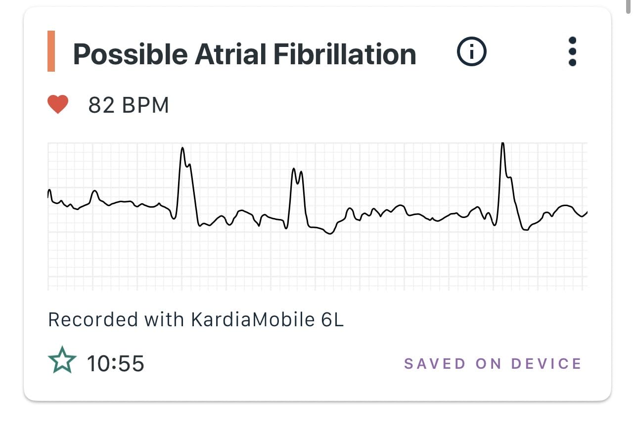 KardiaMobile 6L EKG, No Membership Required, Unlimited Recordings, HSA/FSA | Detects 4 Arrhythmias, FDA-Cleared Heart Monitor, Medical-Grade Results in 30 Seconds, Works with Smartphones and Tablets customer photo 1
